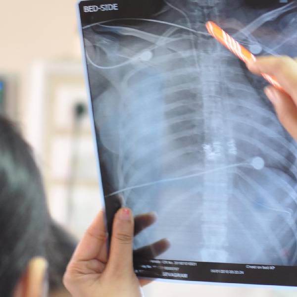Chest Physician in Pune