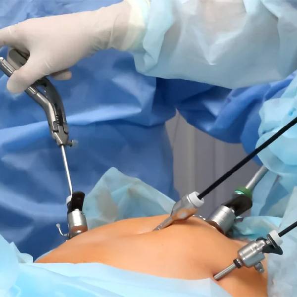 General & Laparoscopic Surgery in Pune