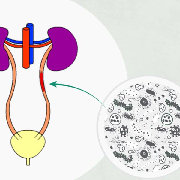 Bladder Infection Treatment in Pune