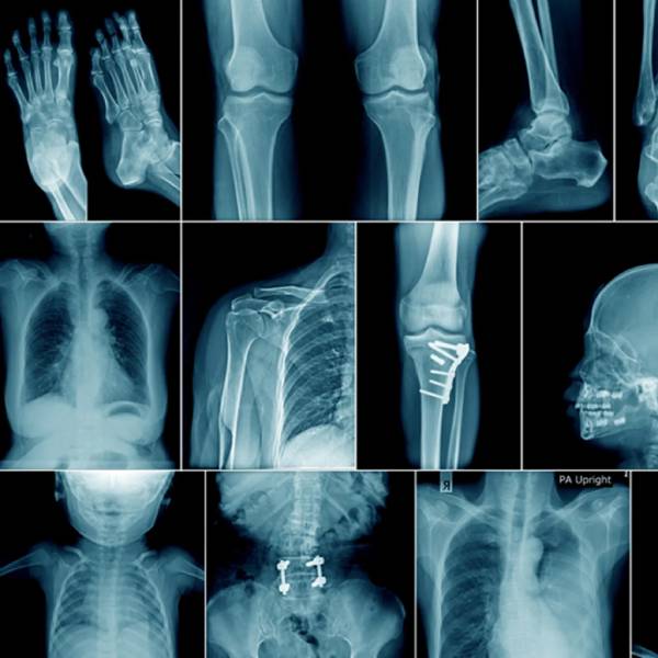 X-Ray Services in Pune