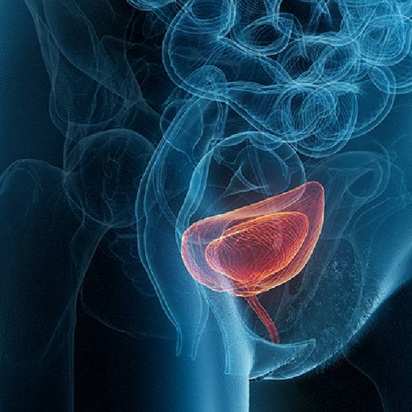 Bladder Cancer Treatment in Pune