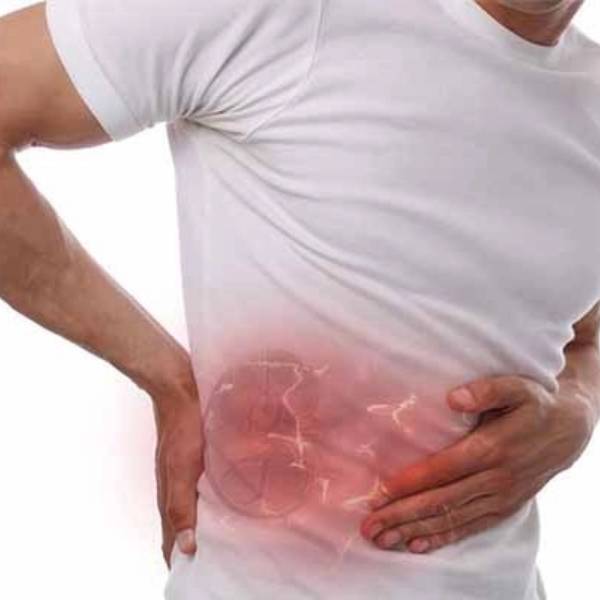Ureteric Stone Treatment in Pune